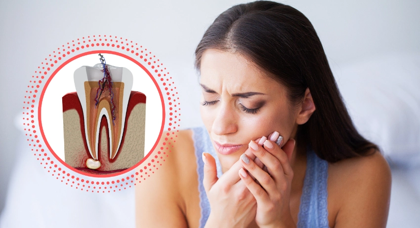 root canal therapy pain