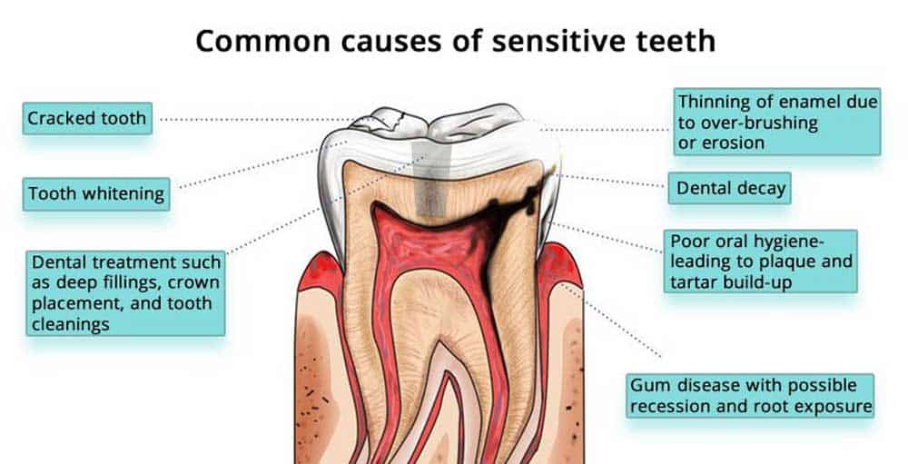 when to worry about tooth sensitivity