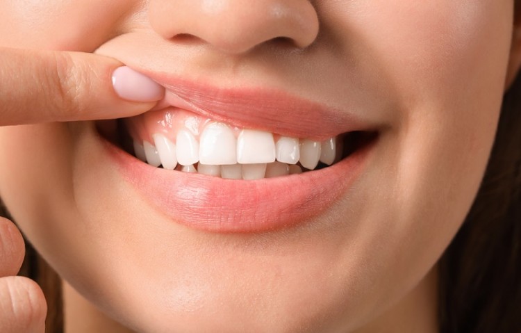 Close-up of the lower jaw of a woman holding her upper lip up with her finger, revealing healthy gums and enamel.