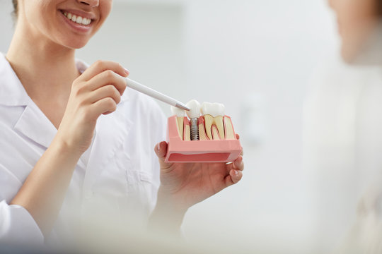 implant toronto